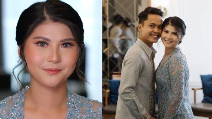 Potret Mitzi Abigail, tunangan pebulu tangkis Anthony Ginting. Berikut  biodatanya.
