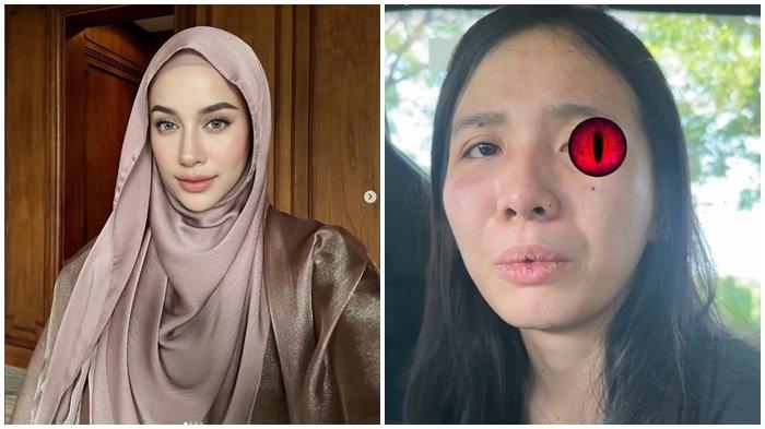 Selebgram Aghnia Punjabi (kiri) dan suster yang menganiaya putrinya