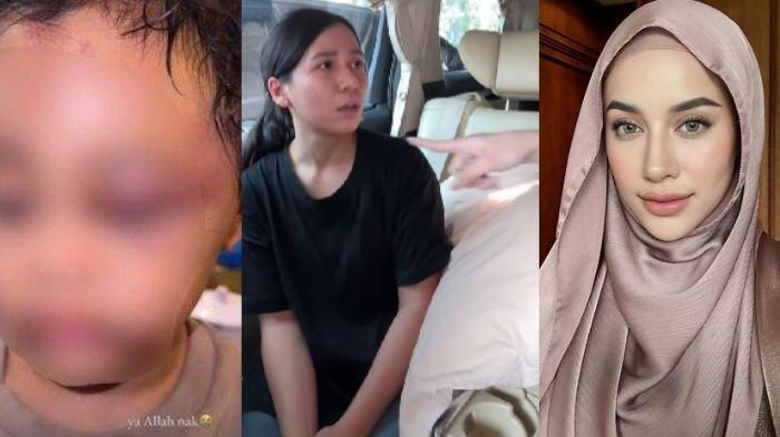 Inilah fakta-fakta soal suster yang tega aniaya anak Aghnia Punjabi, ngaku pernah kerja di Samarinda Kaltim.