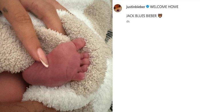 Justin Bieber dan Hailey umumkan kelahiran anak pertama mereka, diberi nama Jack Blues Bieber.