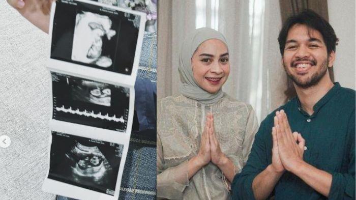 Ira Nandha unggah dirinya hamil anak kedua bersama sang suami, Elmer yang dulu sempat viral diduga selingkuh dengan pramugari.