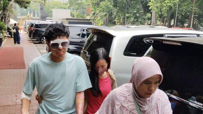 Korban penyiraman air keras bernama Agus Salim (32) tiba di Polda Metro Jaya untuk menjalani pemeriksaan sebagai pelapor atas kasus dugaan pencemaran nama baik, Jumat (1/11/2024).