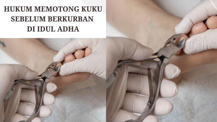 HUKUM POTONG KUKU - Hukum memotong kuku sebelum berkurban. Hari Raya Idul Adha 2025 sudah di depan mata menjelang hari besar ini, kembali ramai diperbincangkan soal hukum memotong kuku sebelum melaksanakan ibadah kurban. (Canva.com)