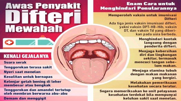 Gejala penyakit difteri dan cara pencegahannya