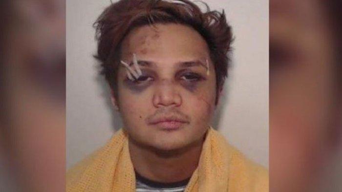 Kepolisian Manchester Raya merilis foto Reynhard Sinaga saat dia ditangkap dalam kondisi babak belur pada 2017 lalu.