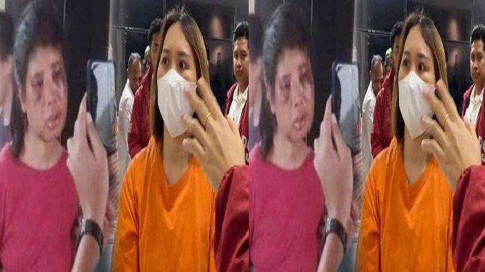 ART ASAL SUMBA - Intan ART asal Sumba yang babak belur disiksa majikannya di Kota Batam, Selasa (24/6/2025).
