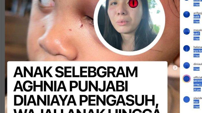 Putri selebgram Aghnia Punjabi diduga dianiaya pengasuh hingga lebam sadis, Simak Kronologisnya di CCTV Berita Viral