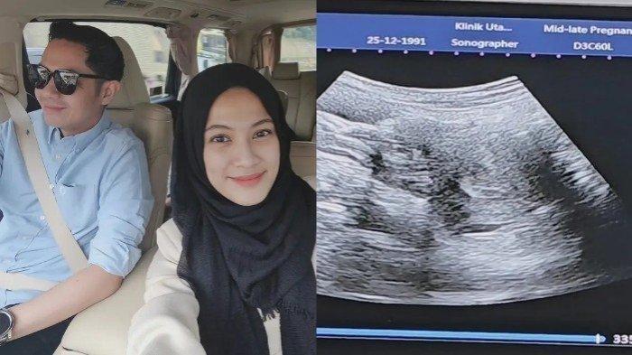 Alyssa Soebandono hamil anak perempuan.