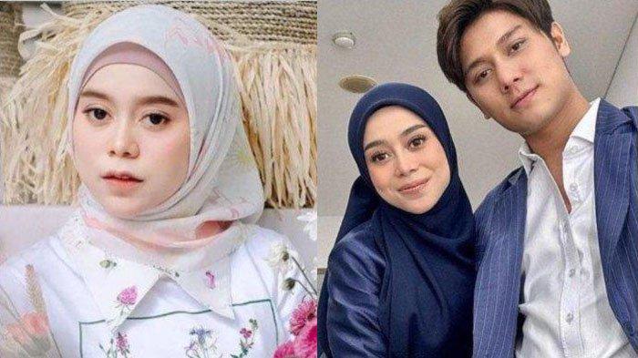 Lesti Kejora Jawab Menohok Tudingan Operasi Hidung: Muka Itu Dirawat