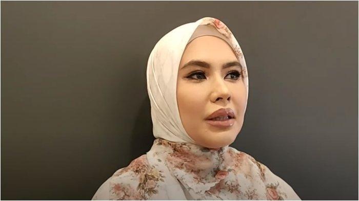 Wajah Kartika Putri kembali mulus usai berobat ke Singapura. Istri Habib Usman langsung balas sindiran Richard Lee.