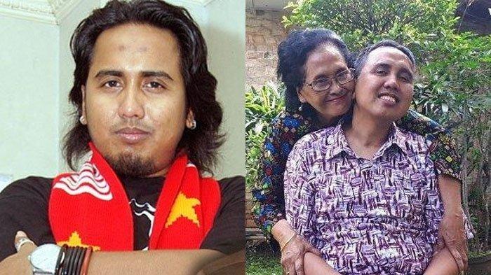 Kondisi Terkini Gugun Gondrong yang Sempat Idap Tumor Otak