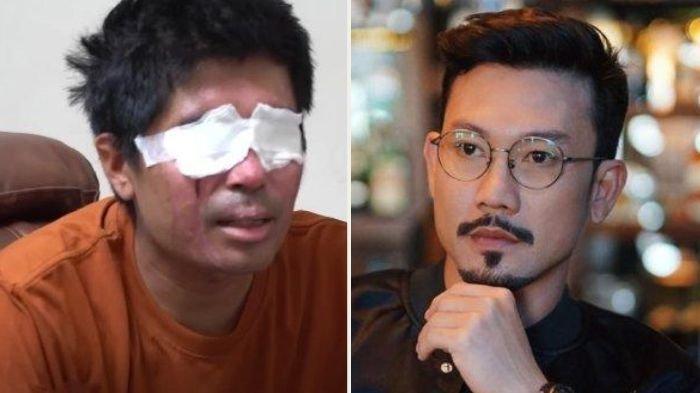 Agus Salim nelangsa donasi miliaran rupiah untuk dirinya dialihkan ke korban bencana alam. Denny Sumargo janji bayari biaya pengobatan korban penyiraman air keras ini.
