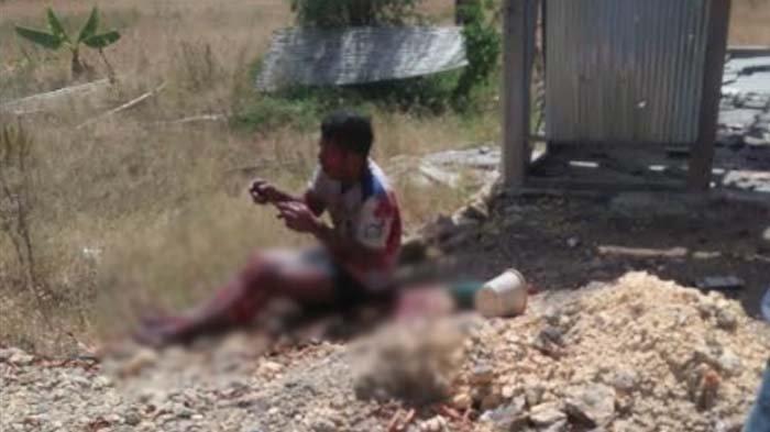 Ainul Yakin, warga Desa Larangan Slampar, Kecamatan Tlanakan, Kabupaten Pamekasan yang menjadi korban ledakan bom di sebuah warung di Desa setempat, Kamis (1/8/2024).