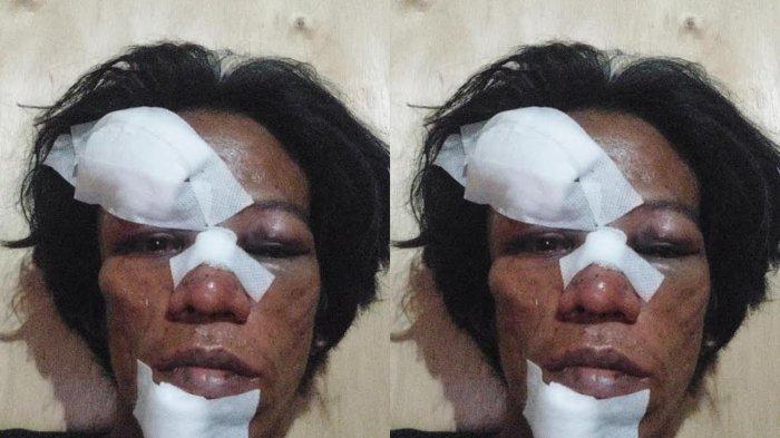 Kolase Haidir Ali saat dirawat usai babak belur diduga tindakan represif polisi saat mengamankan eksekusi 21 rumah di Desa Maroneng, Kabupaten Pinrang, Sulsel