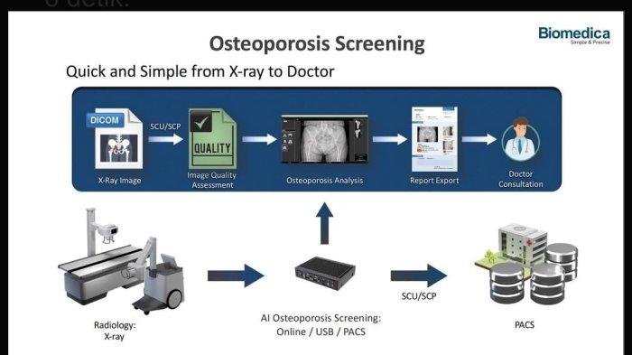 OsteoCloud dirancang untuk menyederhanakan proses deteksi dan diagnosis osteoporosis