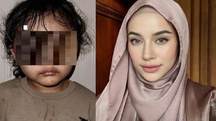 Baru-baru ini, Aghnia Punjabi memberikan kabar yang tak mengenakan tentang hal dialami anaknya. Sang pengasuh yang dipercayakan menjaga anaknya, justru melakukan tindakan kekerasan.