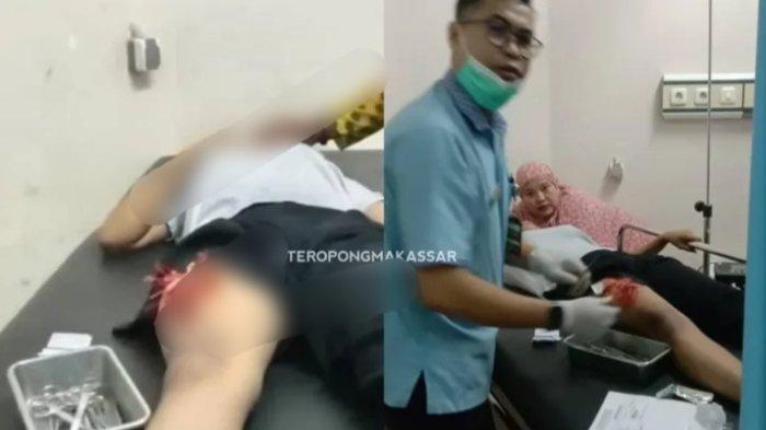 TEROR BUSUR - Tangkapan layar unggahan akun Instagram teropongmakassar terkait perempuan terkena busur di paha, di wilayah Kecamatan Mamajang, Kota Makassar. 
 