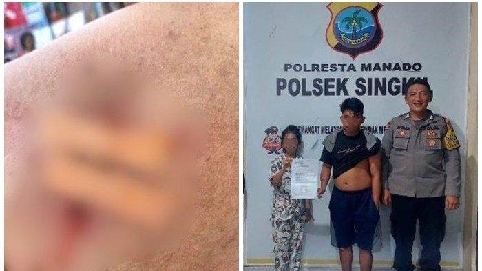 5 Fakta Istri Tikam Suami di Manado, Berawal Miras Sama-sama hingga Kesal karena Korban Sering Mabuk