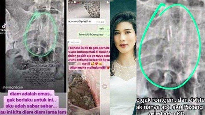 Selain Tubuhnya Dimasuki Benda Misterius, Stevie Agnecya Juga Ngaku Hal Apa yang Terjadi di Rumahnya