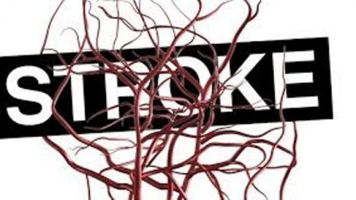 Ilustrasi Stroke