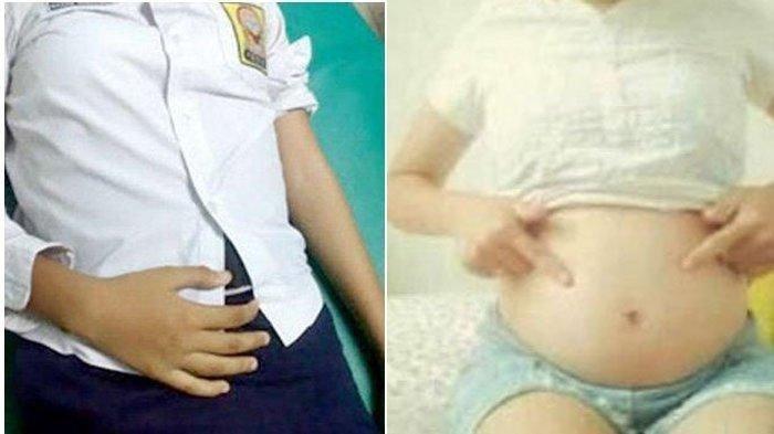 Ilustrasi siswi SMP hamil