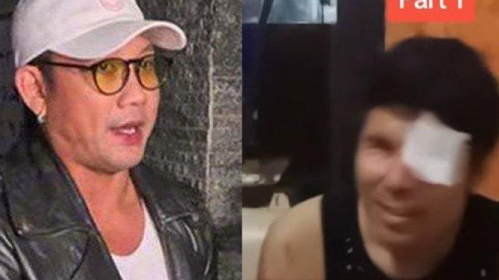 AGUS Salim Asyik Tertawa Sambil Live Saat Donaturnya Keguguran Usai Syok Dilaporkan Farhat Abbas