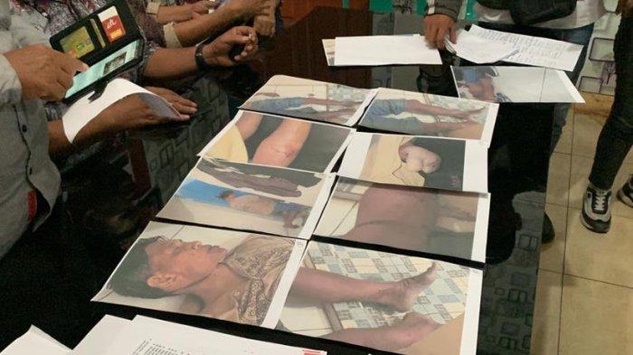 Kejanggalan Kematian Polisi Aipda Gusar Silaen yang sebelumnya Diduga