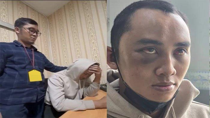 BEGINI Kondisi Calvin Setelah Ditemukan, Tampak Depresi dengan Luka Lebam, Akui Korban KDRT Istri