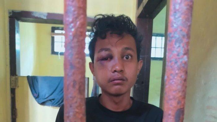 Erwil-Bonyok-Gagal-Begal.jpg
