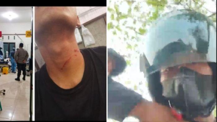 GARA-GARA Rp85 Ribu, Kurir Paket di Bojonegoro Dianiaya Pembeli, Berawal Cekcok di WhatsApp