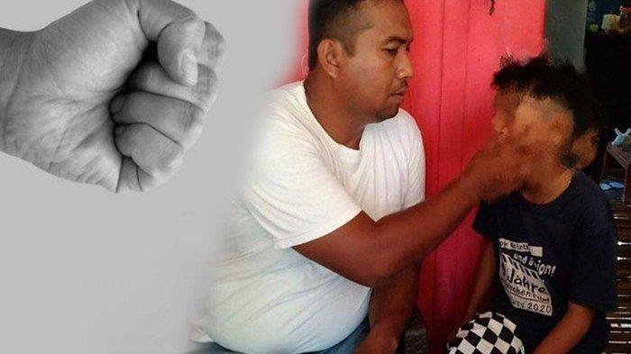 Guru Diduga Tampar Siswa Hingga Giginya Copot, Korban Dipukul Kayu karena Catatannya tak Lengkap