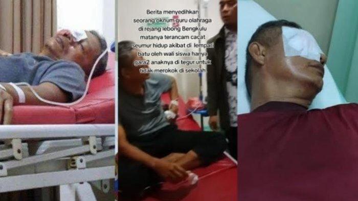 Guru penjas bernama Zaharman (58) diketapel orangtua murid hingga matanya terancam buta.
