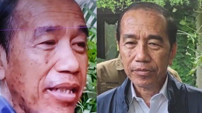 Jokowi Alergi Kulit, Benarkah Terpapar Steven Johnson Syndrom? -  Tribun-medan.com