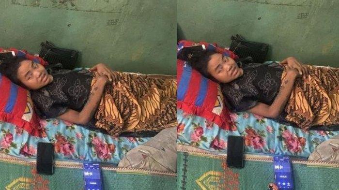 LUMPUH - Ratih Raynada (30) kini hanya mampu berbaring di atas kasur usai tubuhnya lumpuh karena operasi caesar anak keempatnya di RSUD dr Chasbullah Abdulmadjid, Kota Bekasi, pada September 2024.