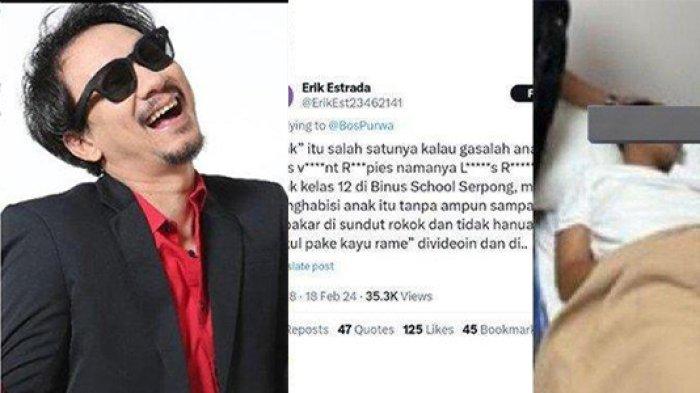KRONOLOGI Lengkap Anak Vincent Rompies Diduga Aniaya Adik Kelas, Leher Dicekik hingga Masuk RS