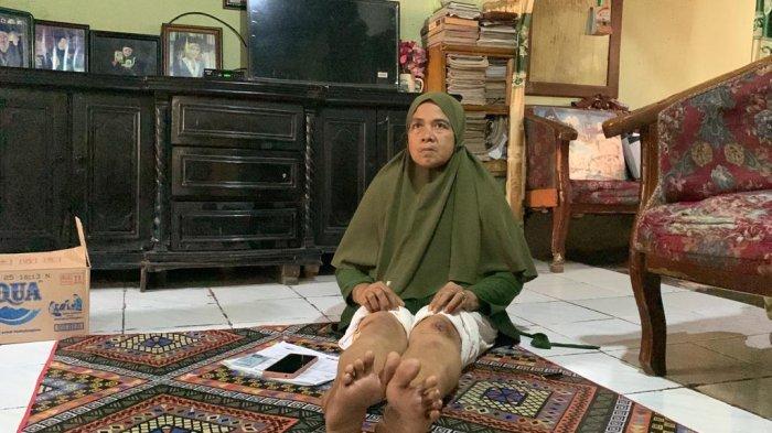 kondisi Nurasyiah, setelah mengalami kecelakaan di Jalan Denai, Kecamatan Medan Denai, Selasa (29/8/2023). 