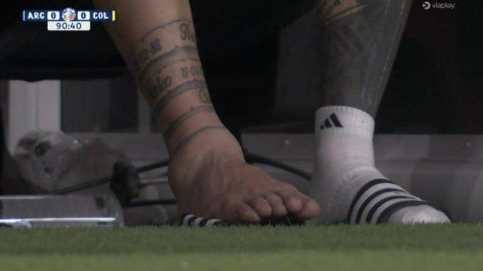 ENGKEL MESSI BENGKAK- Bintang sepak bola Argentina, Lionel Messi tampak mengalami bengkak pada pergelangan kakinya. Messi terluka, saat keluar dan dia menangis, beginilah kondisi pergelangan kakinya. Messi, Kapten Timnas Argentina itu hendak melontarkan umpan silang namun salah melangkah dan akhirnya meleset.