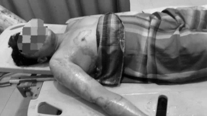 Kondisi Korban Sekaligus pengurus Pondok Pesantren (Ponpes) An Nur yang berada di Desa Batu Melenggang, Kecamatan Hinai, Kabupaten Langkat, Sumatera Utara, dibakar oleh santrinya pada, Sabtu (5/10/2024) kemarin.