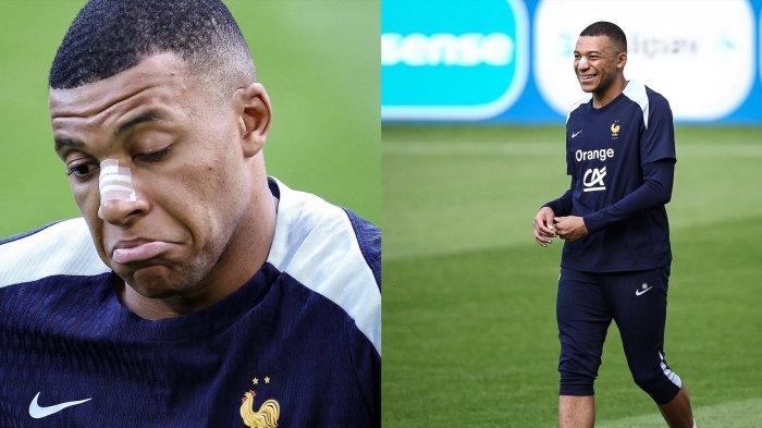 Kylian Mbappe kembali berlatih dengan timnas Prancis dengan hidung diperban
