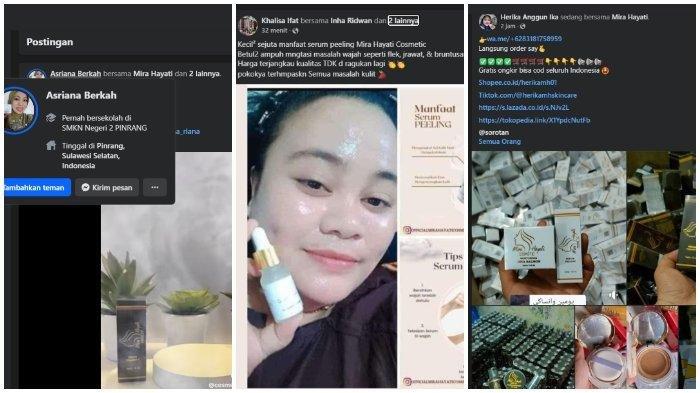 MENGANDUNG Merkuri, Skincare Mira Hayati Masih Dijual Bebas di Marketplace, Ratu Emas tak Ditahan