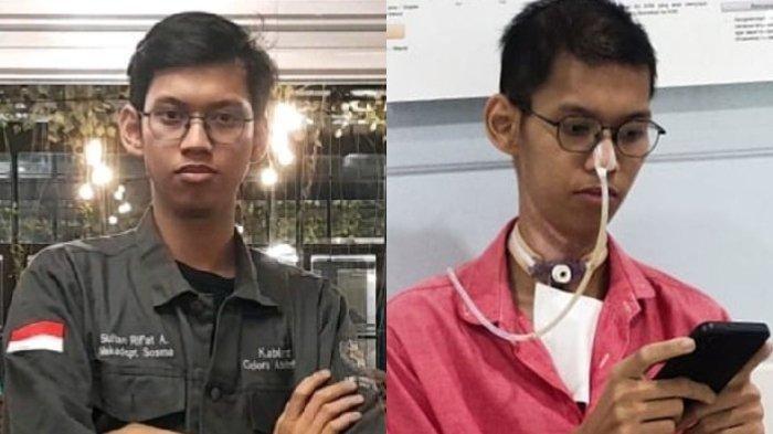 Mahasiswa Universitas Brawijaya, Sultan Rif'at Alfatih (20), tak bisa bicara dan kesulitan bernapas usai kecelakaan terjerat kabel optik yang menjuntai di kawasan Jalan Antasari, Jakarta Selatan pada 5 Januari 2023 lalu.