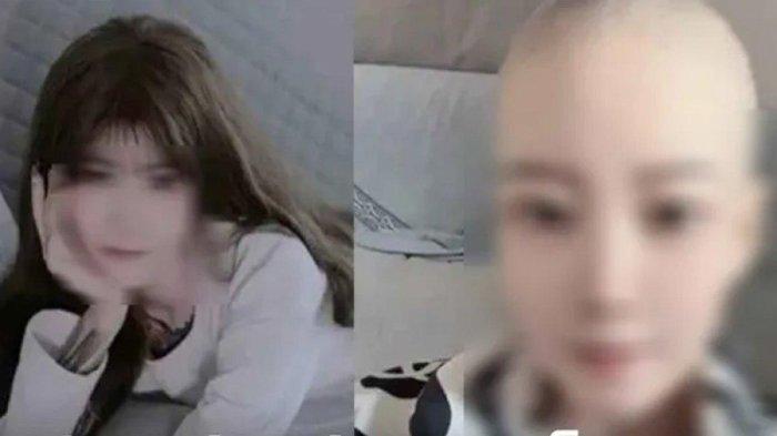 NAHAS Gadis Ingin Tekuni E-Sport Sampai Rela Begadang dan Tahan Kencing,Meninggal Kena Kanker Ginjal