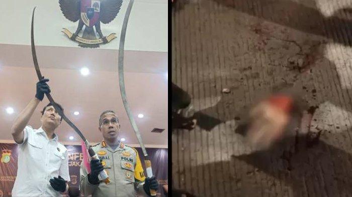 NASIB DSS, Anak Polisi Ikut Tawuran hingga Tangan Putus,Kini Nyesal Tangisi Cita-citanya Jadi Polisi