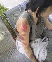 Viral di media sosial video seorang Tenaga Kerja Indonesia (TKI) perempuan asal Kabupaten Karawang, Jawa Barat, mengalami luka bakar parah di sekujur tubuhnya setelah disekap dan dianiaya sepasang suami istri orang Bangladesh dan Yaman di Arab Saudi. (Istimewa)