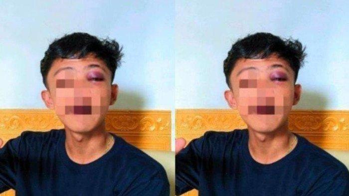 Abdul Aziz Potabuga (17) seorang pelajar asal Kelurahan Dutulana Kecamatan Limboto Kabupaten Gorontalo Provinsi Gorontalo mengaku dianiaya oknum polisi berinisial TA.