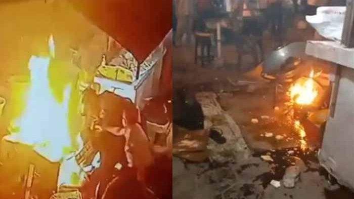 PILU Balita Ketumpahan Minyak Panas Penjual Gorengan, Alami Luka Bakar 64 Persen