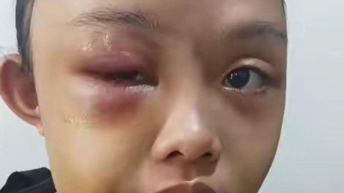 BABAK BELUR - Tangkapan layar video anak yatim piatu babak belur dianiaya tantenya, di Desa Torai Bangun, Kecamatan Tambang, Kabupaten Kampar, Riau, Minggu (25/5/2025)