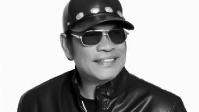 Penyanyi Jack Marpaung Dikabarkan Meninggal Dunia.