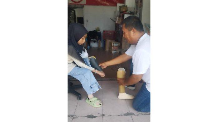 Ramon membantu penyadang disabilitas lainnya untuk pemakaian kaki palsu
