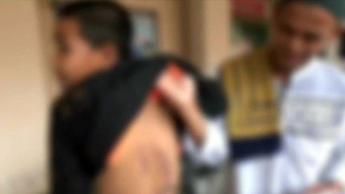 SEORANG santri berusia 13 tahun diduga disetrika gurunya karena tidak mengerjakan PR di salah satu pondok tahfiz di Kota Parepare (istimewa